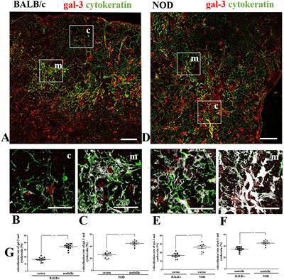 Altered galectin-3 distribution and migratory function in the pre-diabetic non-obese diabetic mouse thymus